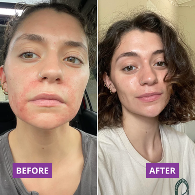 Before and after — Sarah,57