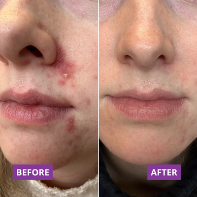 Before and after — Jess,41